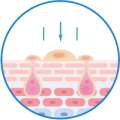 1. SOOTHING